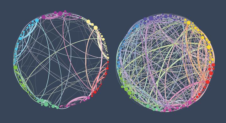 A brain on psychedelics